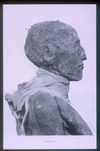 Mummy of Rameses III: head (side view).