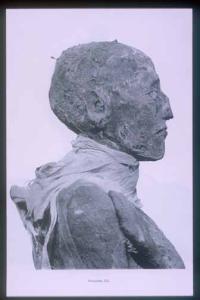 Mummy of Rameses III: head (side view).
